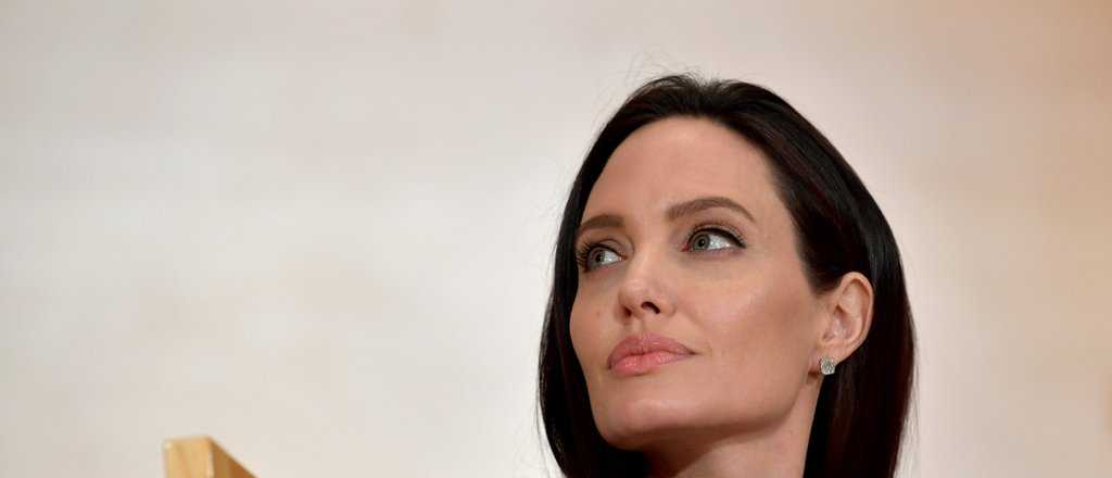 Se operó 50 veces para parecer Angelina Jolie y quedó monstruosa