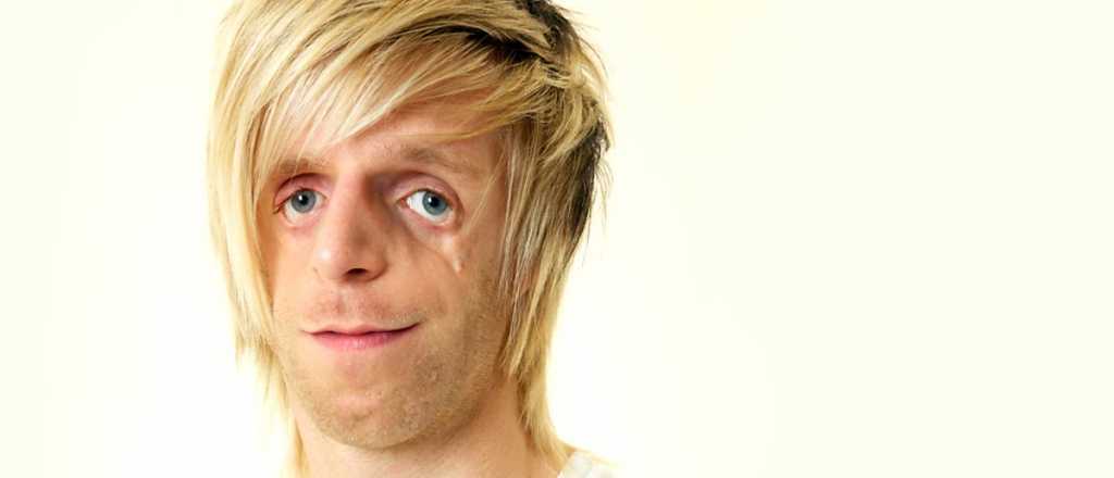 Su caso se viralizó y viene a Mendoza a concientizar sobre su raro síndrome