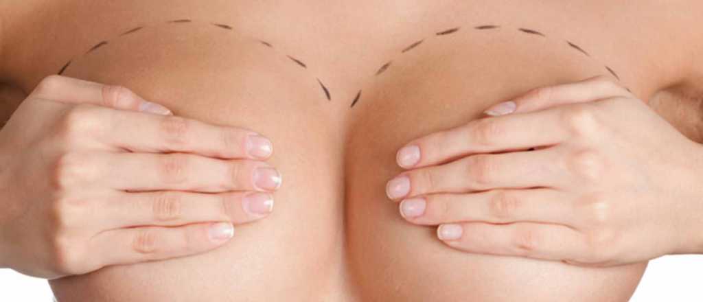 Cómo y por qué las mendocinas deciden recurrir a una mastectomía