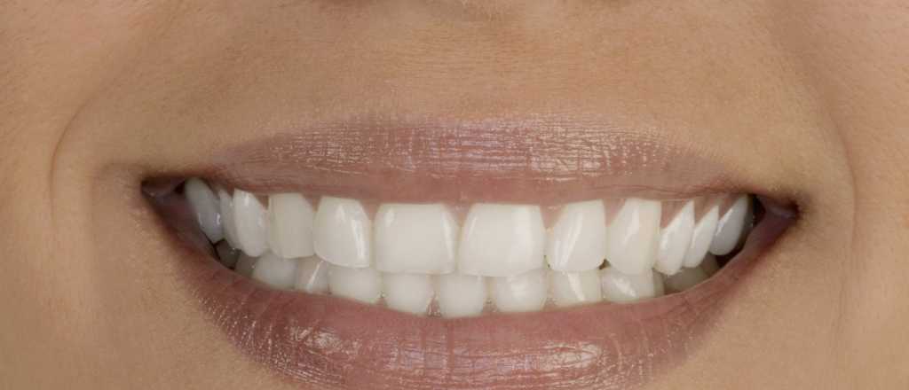 Atenti: las mentiras sobre productos naturales para blanquear los dientes