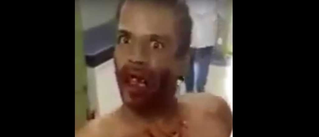 Un hombre "poseído" causó terror en un hospital de Brasil