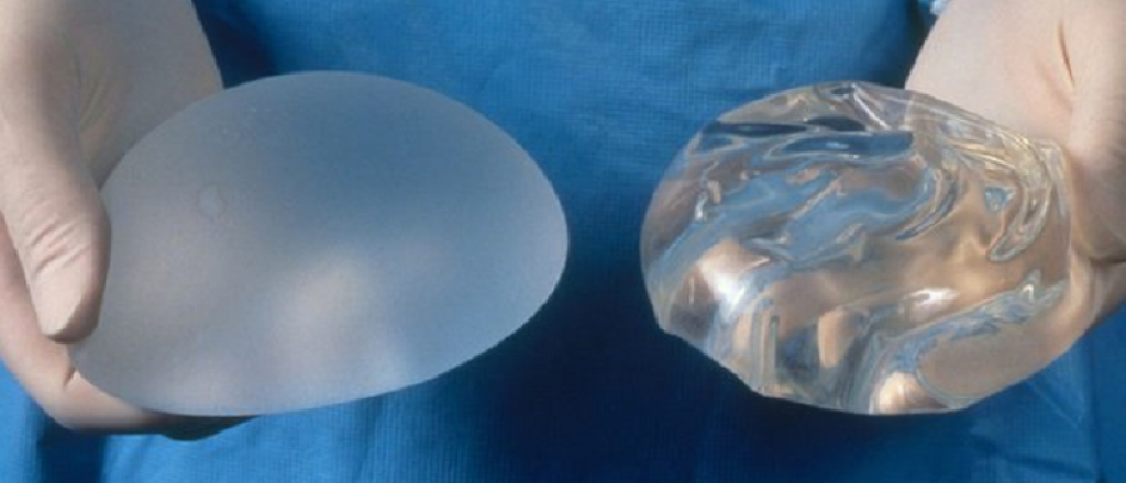 Implantaron una pr&oacute;tesis mamaria con chip por primera vez en el pa&iacute;s