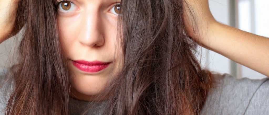 ¿Qué es el síndrome de Rapunzel?