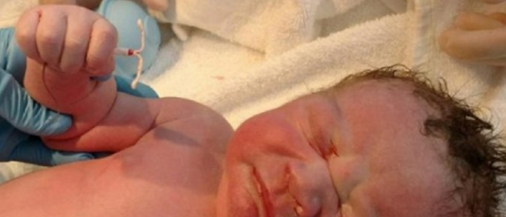Un bebé nació con el DIU en la mano