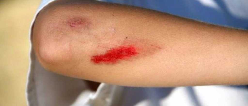 Preocupación en las escuelas por un nuevo juego autolesionante