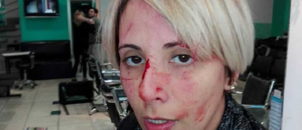 Una mujer fue golpeada por su jefe al preguntarle cuándo iba a cobrar