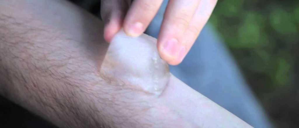 Volvió el peligroso desafío “salt and ice challenge”