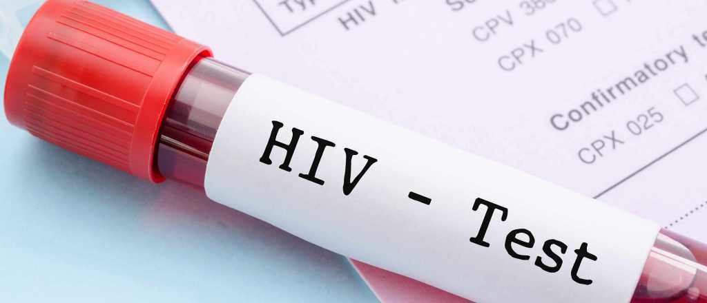 En Mendoza, se diagnostican a 17 personas con VIH por cada 100.000 