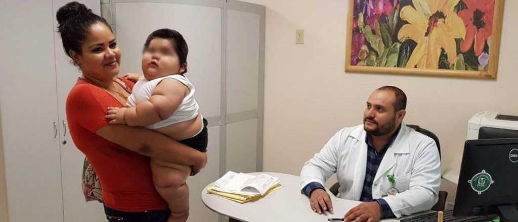 Conmoción en México: tiene 10 meses y sufre obesidad mórbida