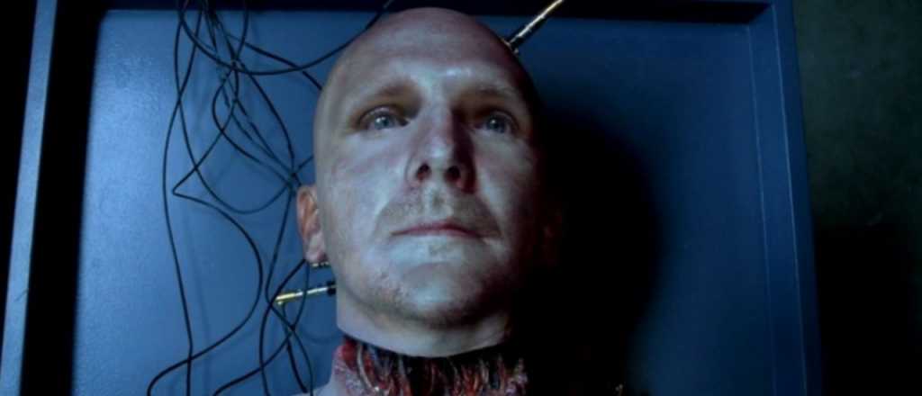 Cirujanos realizan con &eacute;xito el primer trasplante de cabeza 