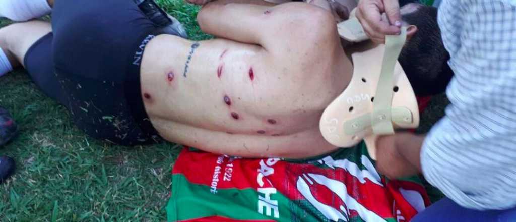 Desmedida represi&oacute;n policial contra los jugadores en un partido liguero