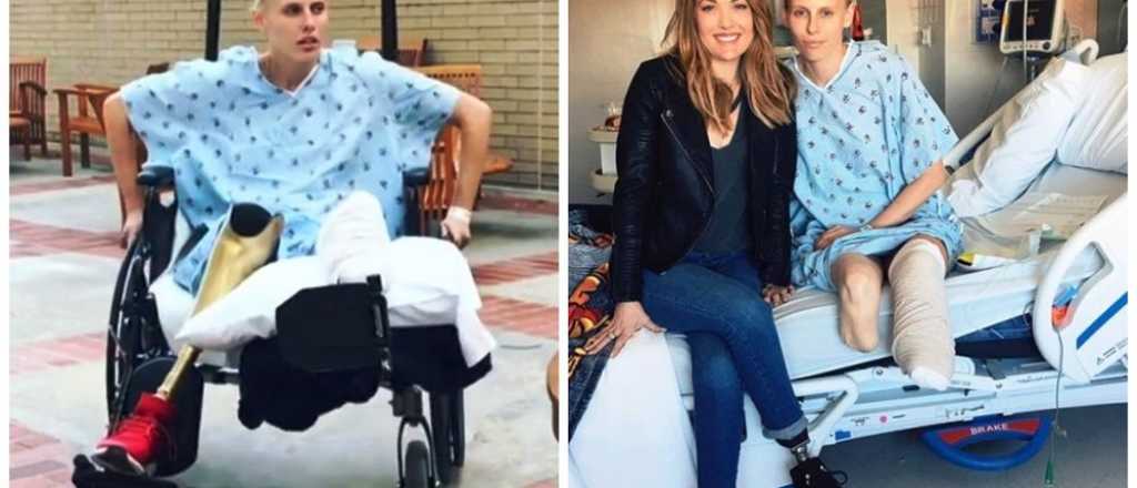 Le amputaron la otra pierna a la modelo infectada por un tampón