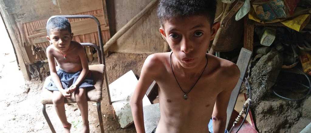 Unicef, en alerta por la grave desnutrición infantil en Venezuela