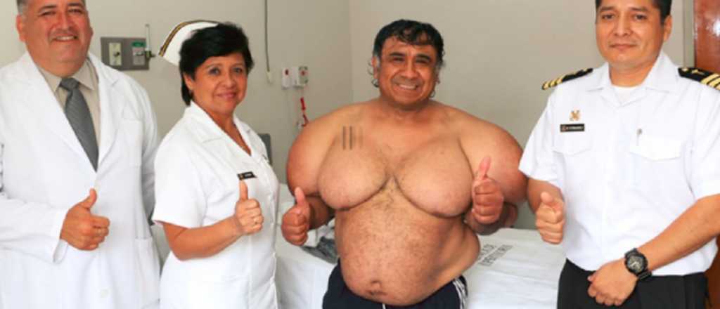 Un buzo peruano ascendi&oacute; de repente y su cuerpo se deform&oacute;