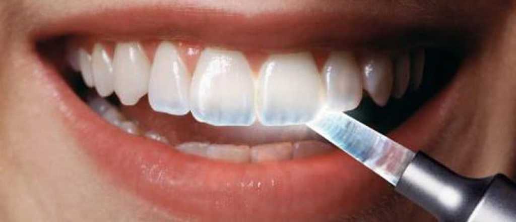 ¿El blanqueamiento dental daña los dientes?