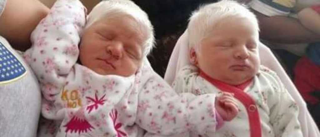 Nacieron dos mellizas albinas en Tucumán
