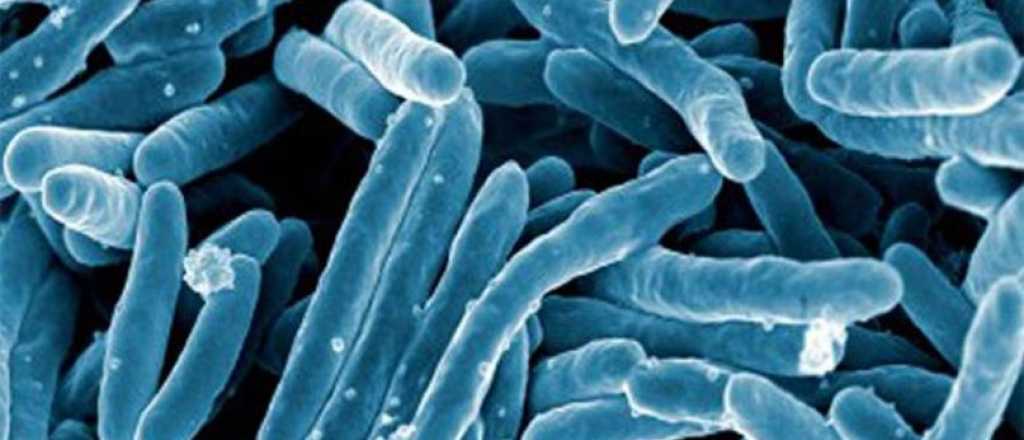 El estr&eacute;s entre las principales causas de enfermedades microbacterianas