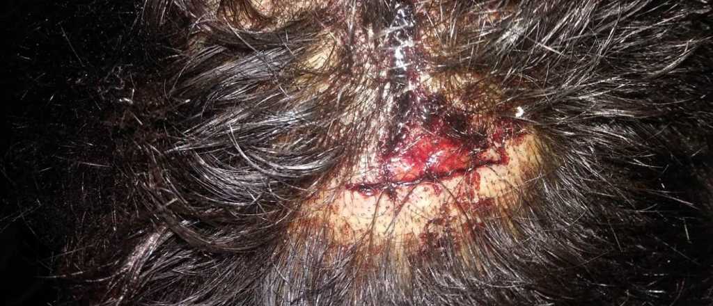 Denunció que desfiguraron a sus hermanos con palos de hockey