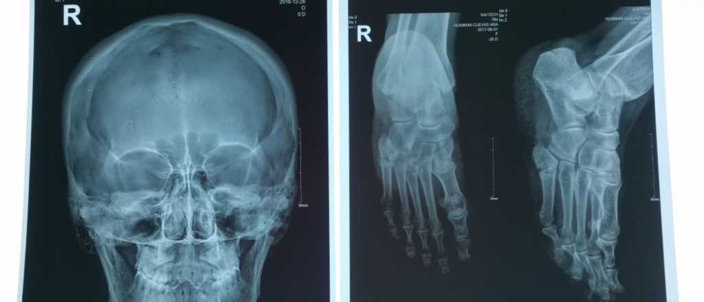 En el Día de la Radiología, ¿cuál es la importancia de los Rayos X?