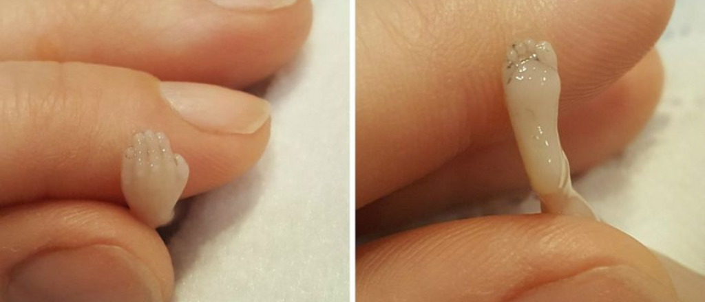 Para concientizar sobre el aborto publicó fotos de su bebé muerto de 14 semanas