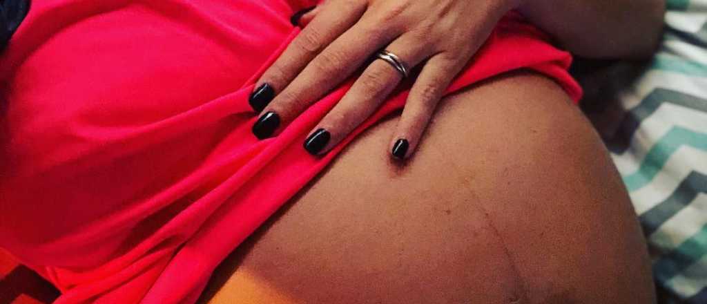 La impactante foto de la beb&eacute; reci&eacute;n nacida de una periodista argentina