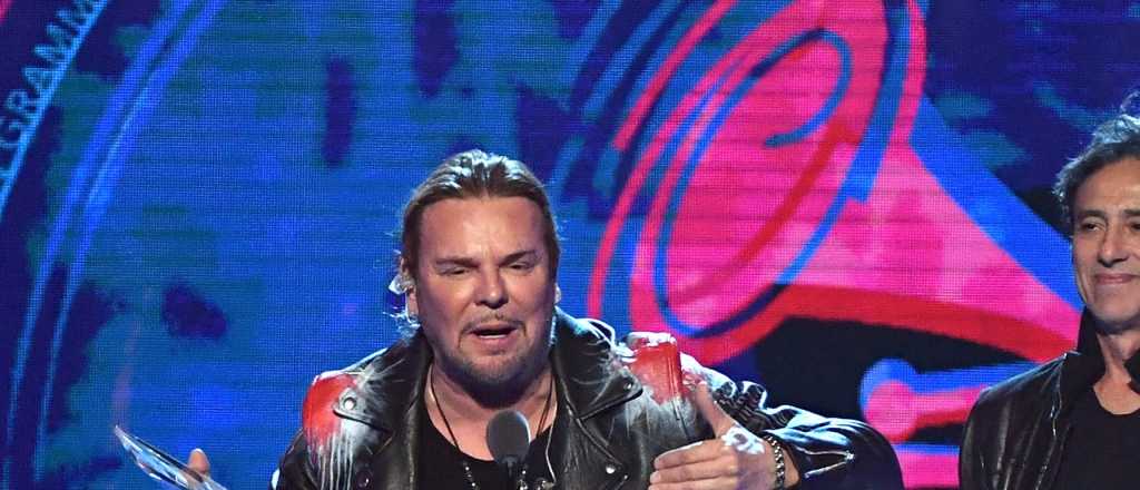 Irreconocible: el cantante de Man&aacute; se oper&oacute; la cara y su mujer lo destroz&oacute;