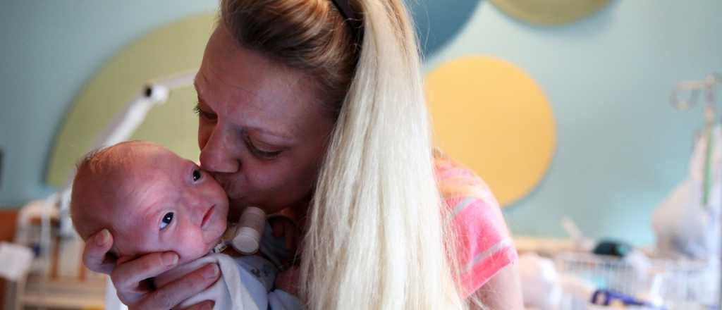 Naci&oacute; un beb&eacute; sin nariz que emocion&oacute; a todo el mundo 