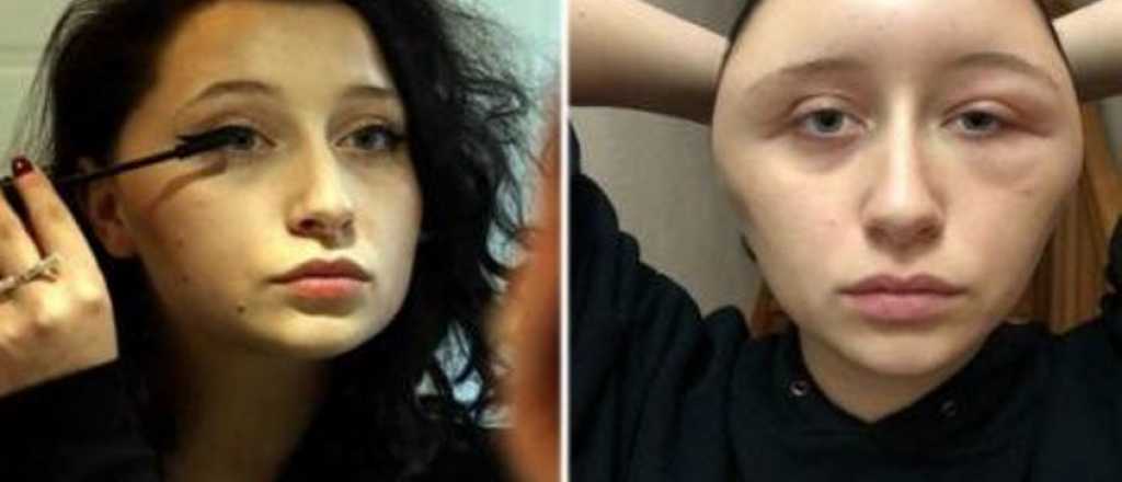 La increíble deformación que sufrió una joven al teñirse el pelo