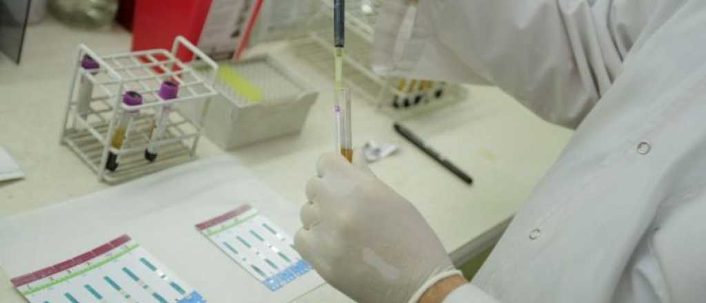 Hay provisión garantizada de medicamentos para tratar VIH en todo el país