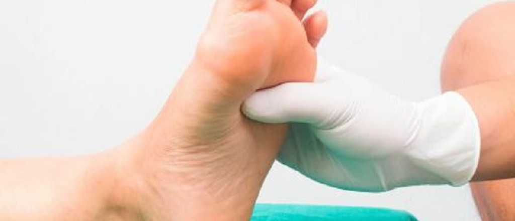 Pie diab&eacute;tico: &iquest;c&oacute;mo evitar las infecciones?