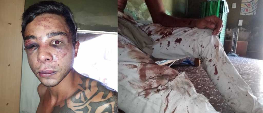 Un joven denunció que le dieron una paliza en un boliche en Godoy Cruz