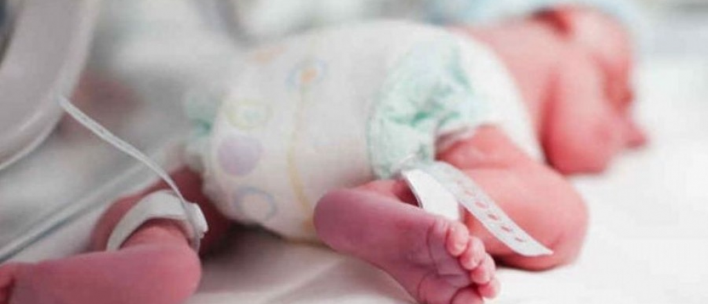 Un beba en Colombia naci&oacute; con un "gemelo par&aacute;sito"