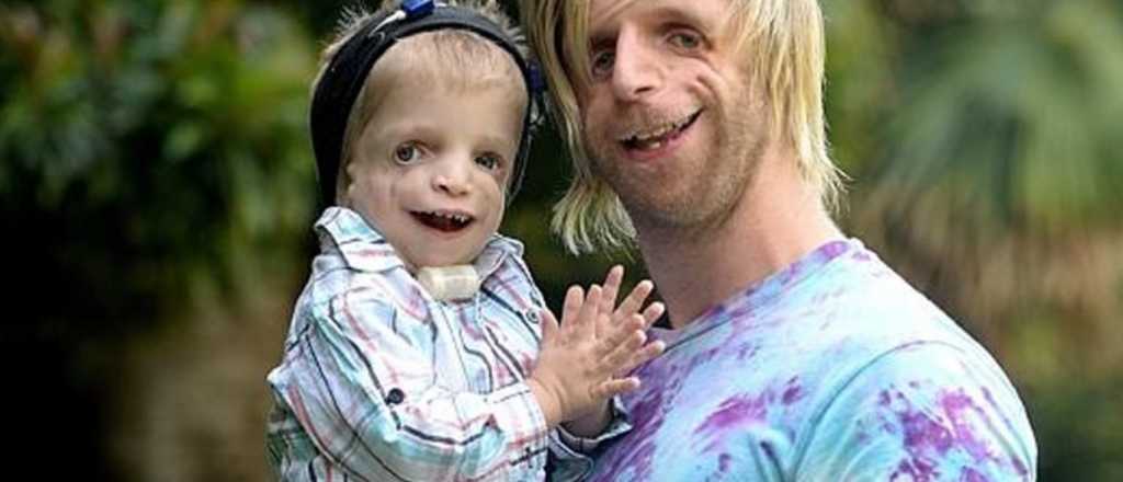 Un joven viajó 10 mil kilómetros por un niño con su misma enfermedad