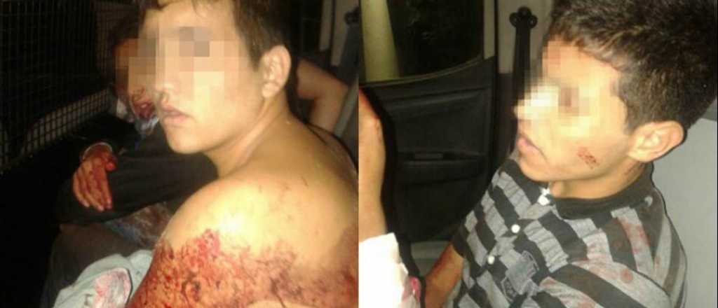 Así quedaron los ladrones heridos por el "samurai cordobés"