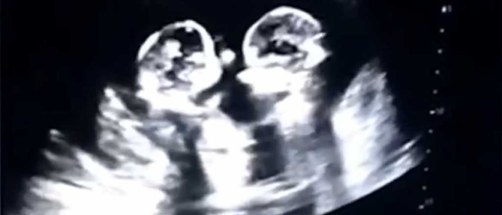 Video: gemelas a los "golpes" en la panza de su mamá