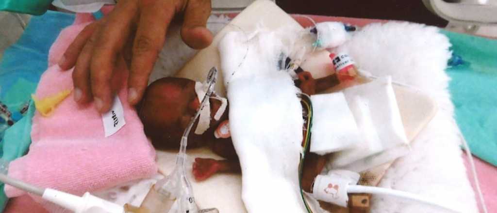 El "beb&eacute; m&aacute;s chiquito" del mundo recibir&aacute; el alta