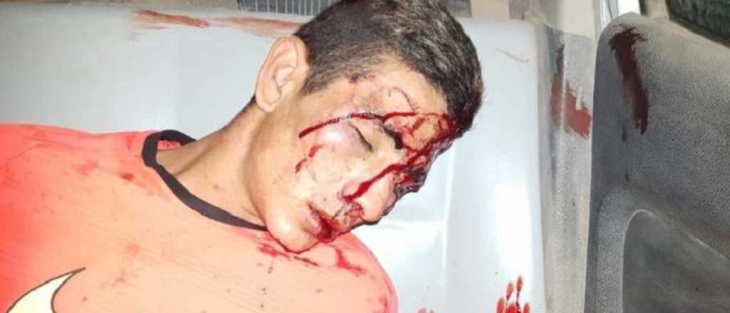 Un hombre asalt&oacute; a una anciana y los nietos le dieron una golpiza