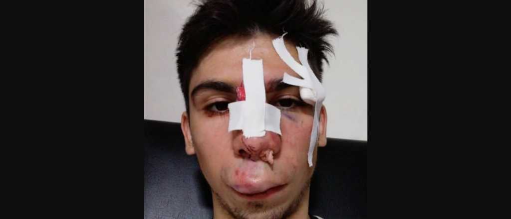 Una caída le desfiguró la cara a un jugador mendocino de futsal 
