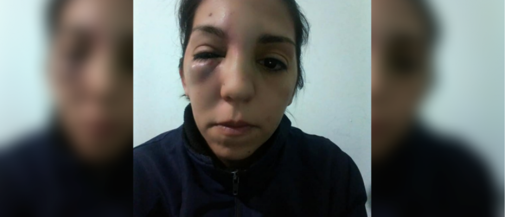 Brutal golpiza a una joven en San Rafael para robarle una bicicleta