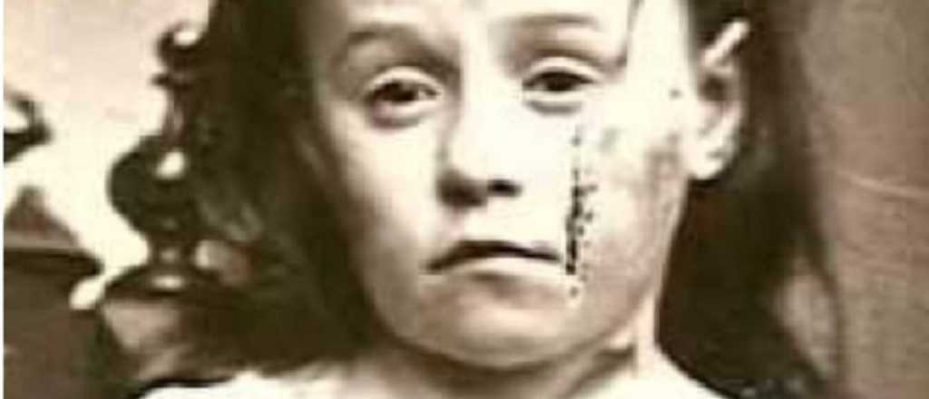 Cuando los ni&ntilde;os no ten&iacute;an derechos, la salvaron protectores de animales