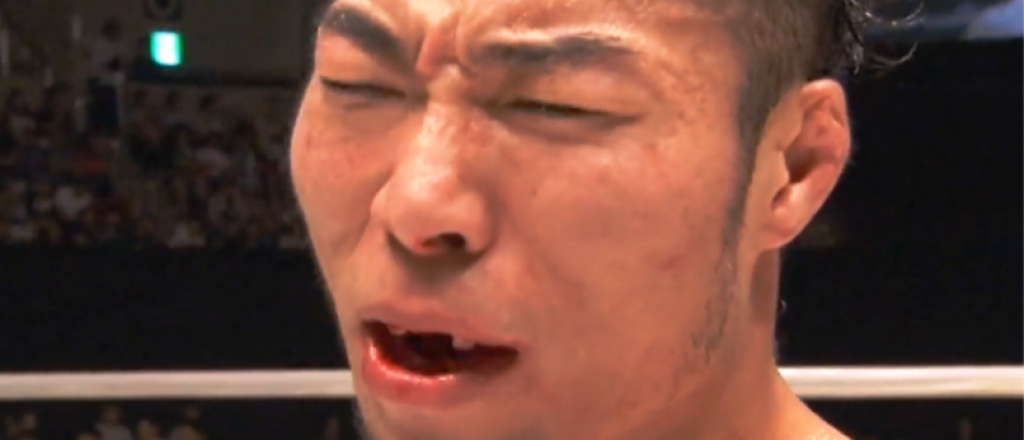 Video: le rompieron los dientes en una pelea de MMA