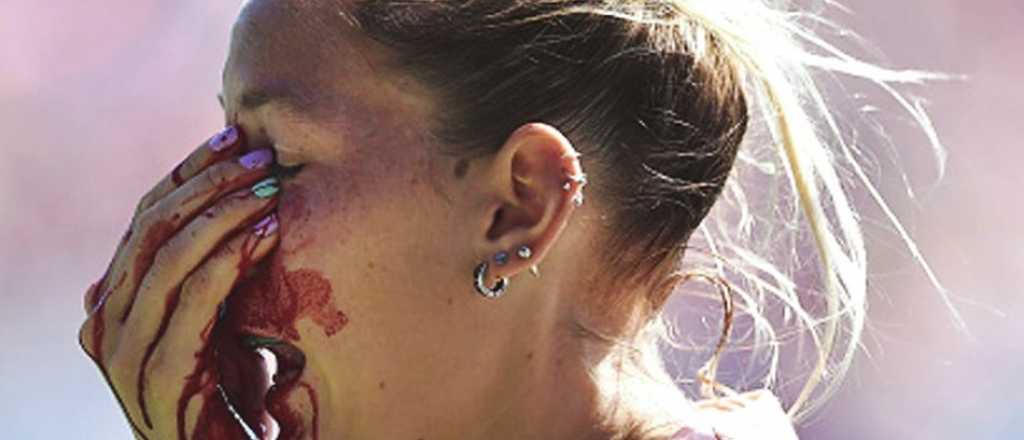Video y fotos: durísimo bochazo en la cara a una Leona