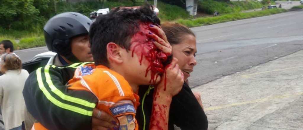 Venezuela: un chico de 16 años perdió los ojos por disparos en una protesta