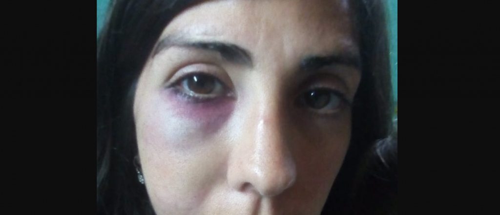 La golpe&oacute;, perdi&oacute; el embarazo y muri&oacute; pero no reconocen el femicidio