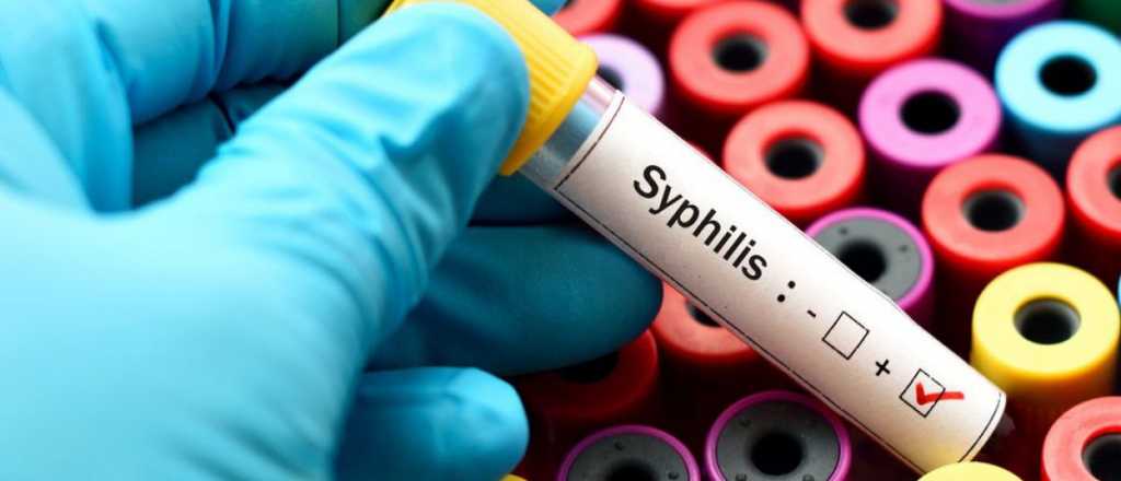 Preocupación en Mendoza por el crecimiento de casos de sífilis