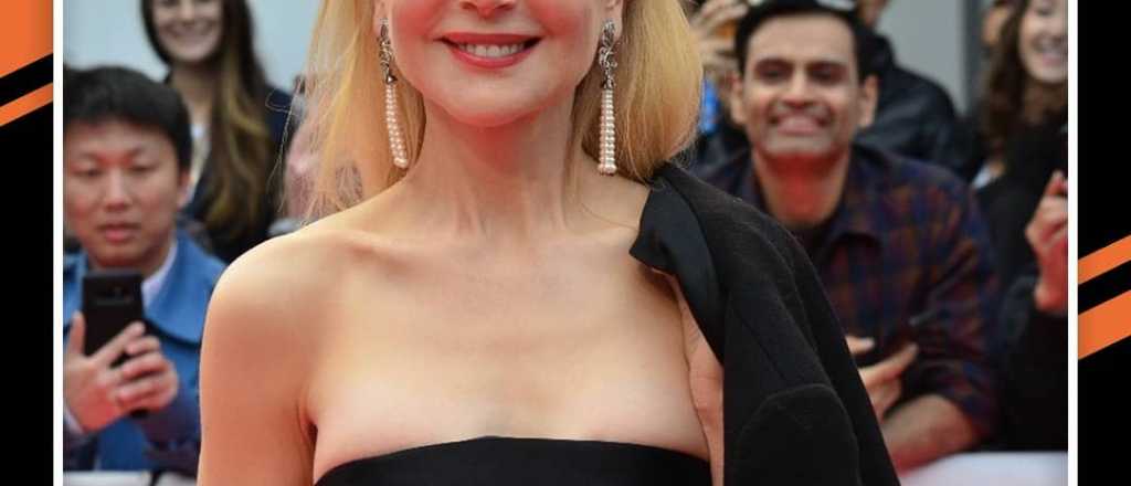 &iquest;Qu&eacute; se hizo Nicole Kidman en la cara?