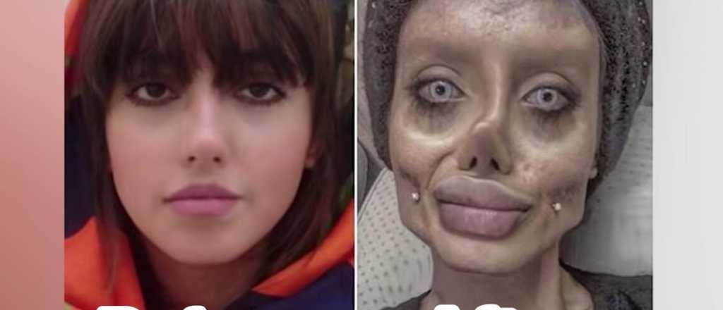 Cárcel para la influencer iraní que se desfiguró para ser Angelina Jolie