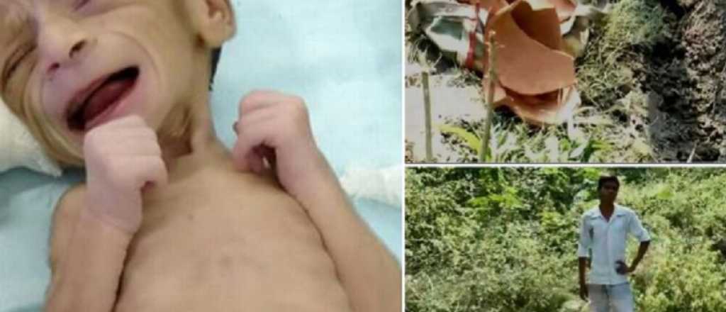 La beb&eacute; milagro: la hallaron enterrada viva, era prematura y se recupera
