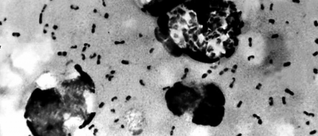 Dos personas fueron diagnosticadas con peste negra