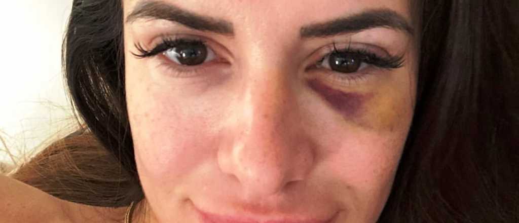 La pareja de Cristaldo cont&oacute; con detalles c&oacute;mo fue la agresi&oacute;n que sufri&oacute;